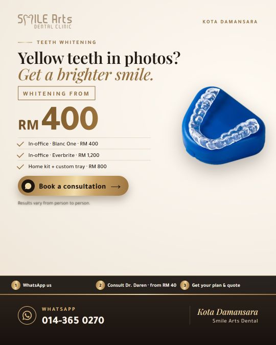 Smile Arts whitening ad, from RM 400
